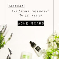 You probably never heard of centella before, but it is amazing for ance scars. Click to read more about centella