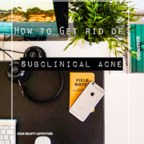 After several trial and error, I finally figured out how to I clear my subclinical acne. Click to find out how you too can get back your clear skin.