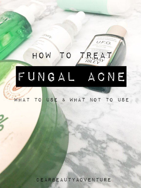 How-to-treat-fungal-Acne